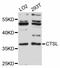 Cathepsin L antibody, abx125734, Abbexa, Western Blot image 