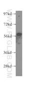 Methylcrotonoyl-CoA Carboxylase 2 antibody, 12117-1-AP, Proteintech Group, Western Blot image 