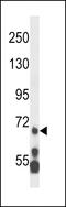 Lysine Methyltransferase 2E antibody, LS-C164217, Lifespan Biosciences, Western Blot image 