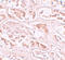 BTG3 Associated Nuclear Protein antibody, A05764, Boster Biological Technology, Immunohistochemistry paraffin image 