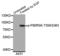 Ribosomal Protein S6 Kinase A1 antibody, STJ113490, St John