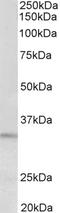 Peptidase Inhibitor 15 antibody, STJ72740, St John