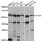 Integrin Subunit Beta 3 antibody, LS-C746708, Lifespan Biosciences, Western Blot image 