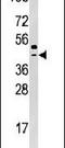 Selenide, water dikinase 2 antibody, PA5-14003, Invitrogen Antibodies, Western Blot image 