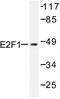 E2F-1 antibody, LS-C176276, Lifespan Biosciences, Western Blot image 