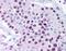 L/S Afadin antibody, orb86937, Biorbyt, Immunohistochemistry paraffin image 