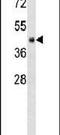 CGAS antibody, PA5-24012, Invitrogen Antibodies, Western Blot image 