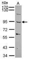 Thrombospondin Type 1 Domain Containing 1 antibody, NBP2-20624, Novus Biologicals, Western Blot image 