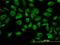 Tubulin Alpha 1c antibody, H00084790-M04, Novus Biologicals, Immunocytochemistry image 