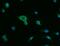 Acid Phosphatase, Prostate antibody, A02082-2, Boster Biological Technology, Immunofluorescence image 