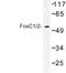 Forkhead Box C1 antibody, LS-C176926, Lifespan Biosciences, Western Blot image 