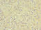 SRI antibody, LS-C376676, Lifespan Biosciences, Immunohistochemistry paraffin image 