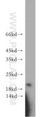 Adenine Phosphoribosyltransferase antibody, 21405-1-AP, Proteintech Group, Western Blot image 