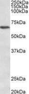 Calcium Voltage-Gated Channel Auxiliary Subunit Beta 2 antibody, MBS422636, MyBioSource, Western Blot image 