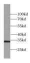 Sulfotransferase Family 1A Member 1 antibody, FNab08377, FineTest, Western Blot image 