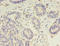 RAD17 Checkpoint Clamp Loader Component antibody, A50440-100, Epigentek, Immunohistochemistry paraffin image 