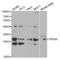 Peroxiredoxin 4 antibody, LS-C331490, Lifespan Biosciences, Western Blot image 