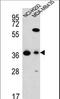 Fumarylacetoacetate Hydrolase Domain Containing 2A antibody, LS-C165920, Lifespan Biosciences, Western Blot image 