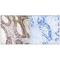 Serine/Threonine Kinase 24 antibody, A04112, Boster Biological Technology, Immunohistochemistry paraffin image 