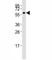 Matrix Metallopeptidase 14 antibody, F40218-0.4ML, NSJ Bioreagents, Western Blot image 