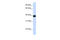 MAF BZIP Transcription Factor A antibody, ARP47760_P050, Aviva Systems Biology, Western Blot image 