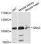 Glucosylceramidase Beta 2 antibody, LS-C747904, Lifespan Biosciences, Western Blot image 