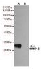 Matrix Metallopeptidase 2 antibody, STJ99213, St John