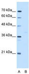 GDP-Mannose Pyrophosphorylase B antibody, TA346814, Origene, Western Blot image 