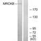 CDC42 Binding Protein Kinase Beta antibody, A07454, Boster Biological Technology, Western Blot image 