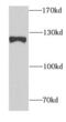 Staphylococcal Nuclease And Tudor Domain Containing 1 antibody, FNab08064, FineTest, Western Blot image 