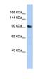 Arfaptin-2 antibody, orb324455, Biorbyt, Western Blot image 