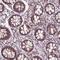 Zinc Finger Protein 555 antibody, PA5-63128, Invitrogen Antibodies, Immunohistochemistry frozen image 
