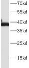 Fc Fragment Of IgE Receptor II antibody, FNab01448, FineTest, Western Blot image 