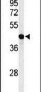 Glycerol-3-Phosphate Acyltransferase 4 antibody, PA5-26651, Invitrogen Antibodies, Western Blot image 