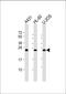RAB5C, Member RAS Oncogene Family antibody, M05148, Boster Biological Technology, Western Blot image 