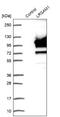 Leucine Rich Repeat And Sterile Alpha Motif Containing 1 antibody, NBP1-82017, Novus Biologicals, Western Blot image 