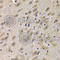 Complement C1q A Chain antibody, A1821, ABclonal Technology, Immunohistochemistry paraffin image 