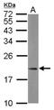 Mitochondrial Ribosomal Protein L21 antibody, NBP2-19401, Novus Biologicals, Western Blot image 