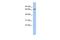 Protein Disulfide Isomerase Family A Member 4 antibody, GTX46431, GeneTex, Western Blot image 