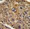 Transducer Of ERBB2, 1 antibody, LS-C160103, Lifespan Biosciences, Immunohistochemistry paraffin image 