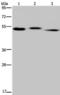 Hyaluronidase 3 antibody, PA5-50427, Invitrogen Antibodies, Western Blot image 