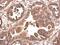 Eukaryotic Translation Initiation Factor 4A2 antibody, PA5-27431, Invitrogen Antibodies, Immunohistochemistry paraffin image 