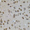 Interferon Regulatory Factor 1 antibody, 23-112, ProSci, Immunohistochemistry paraffin image 