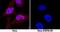 Signal Transducer And Activator Of Transcription 5B antibody, MAB15841, R&D Systems, Immunocytochemistry image 