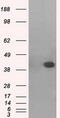 Mitogen-Activated Protein Kinase 11 antibody, M03738-2, Boster Biological Technology, Western Blot image 
