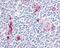 CD49D antibody, 48-389, ProSci, Immunohistochemistry frozen image 