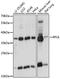 60S ribosomal protein L6 antibody, A15094, ABclonal Technology, Western Blot image 