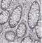 Nucleolar Protein Interacting With The FHA Domain Of MKI67 antibody, NBP2-36749, Novus Biologicals, Immunohistochemistry paraffin image 