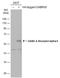 Gamma-Aminobutyric Acid Type A Receptor Alpha5 Subunit antibody, GTX118345, GeneTex, Western Blot image 