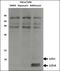 Microtubule Associated Protein 1 Light Chain 3 Alpha antibody, LS-C165694, Lifespan Biosciences, Western Blot image 